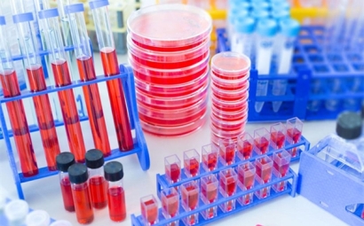 進(jìn)口細(xì)胞清關(guān)需要哪些資料，了解一下！